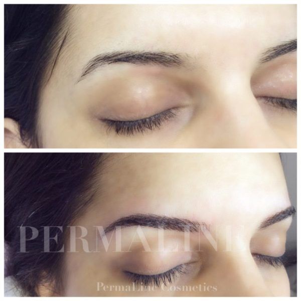 A woman's eyebrows before and after treatment.