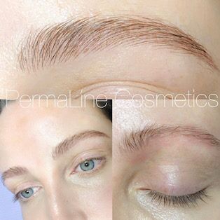 A woman's eyebrows before and after treatment.
