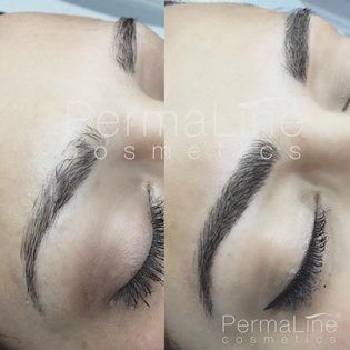 A woman's eyebrows before and after treatment.