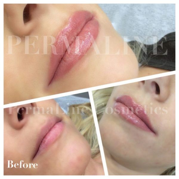 A before and after photo of a woman's lips.