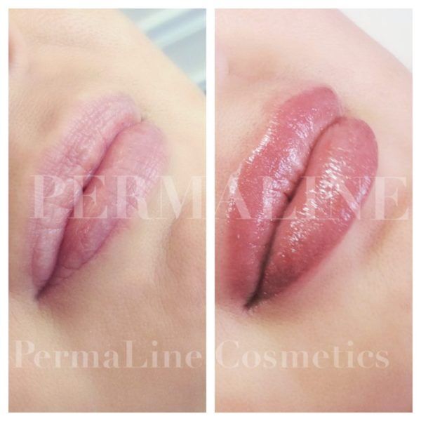 Two pictures of a woman's lips before and after lip filler.