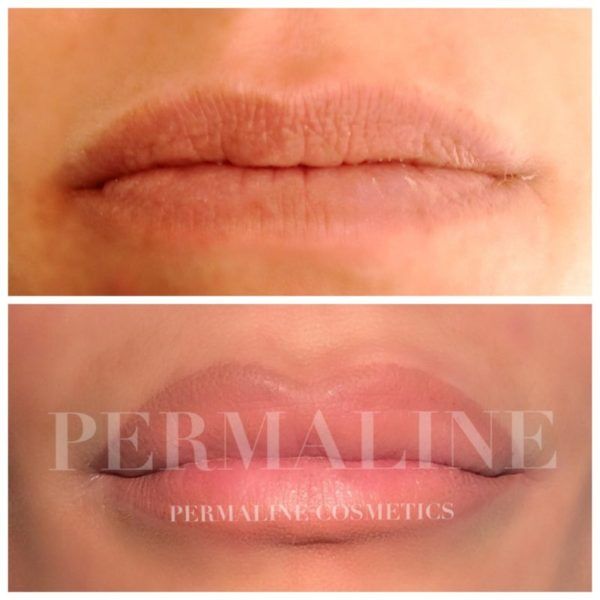 A before and after photo of a woman's lips.